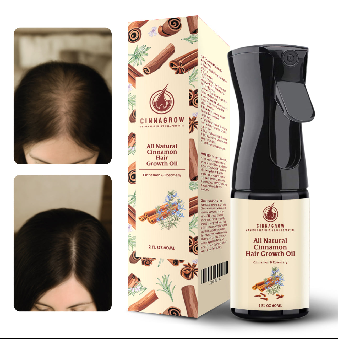 CINNAGROW - Hair Growth Oil